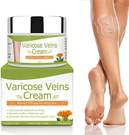 Varicose Veins Cream